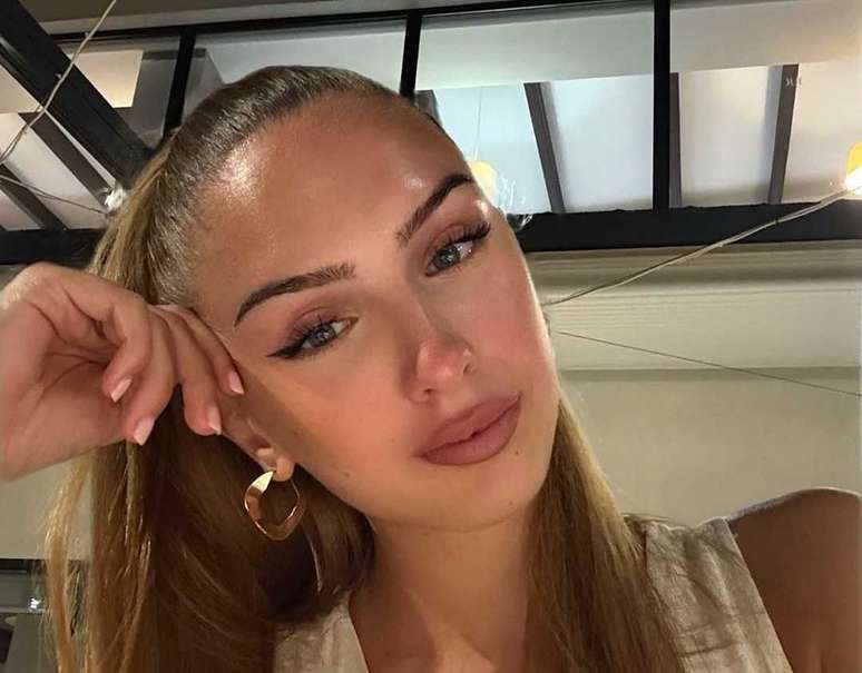 Miss Áustria morre aos 22 anos; modelo passou por 7 cirurgias cardíacas