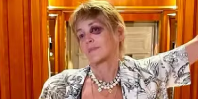Sharon Stone preocupa f&atilde;s ao mostrar olho roxo em f&eacute;rias na Turquia Foto: Reprodu&ccedil;&atilde;o/Instagram