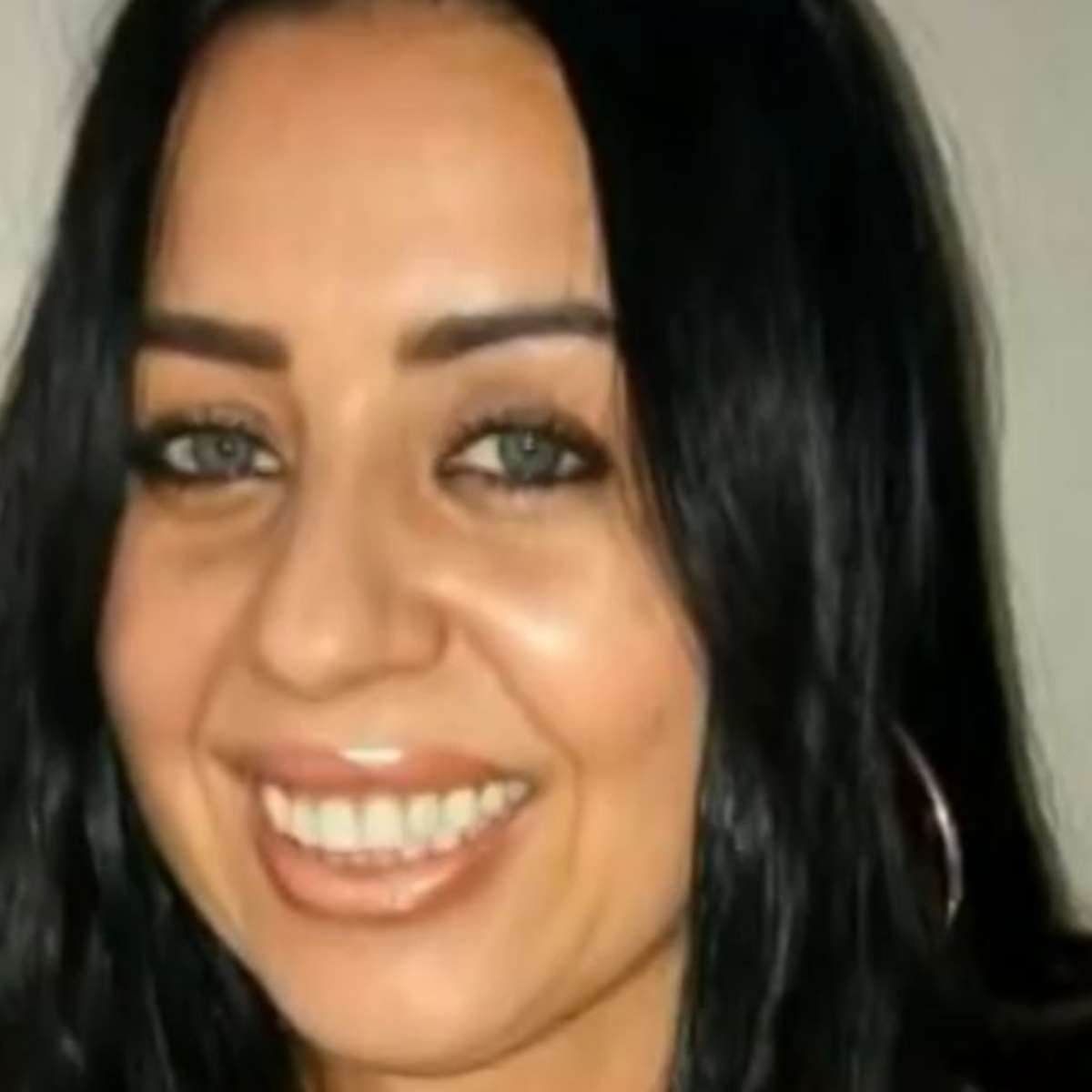 Polícia investiga morte de professora após injeção para tratar queda de cabelo no DF